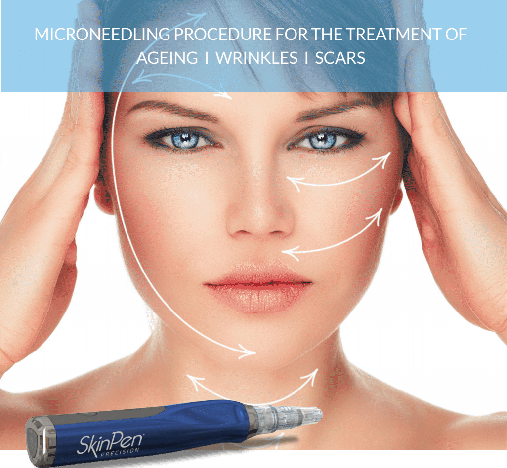Micro-Needling – SkinPen Precision